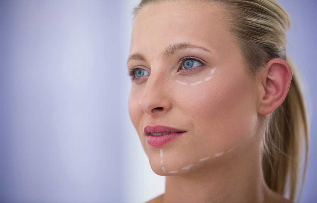 lifting facial