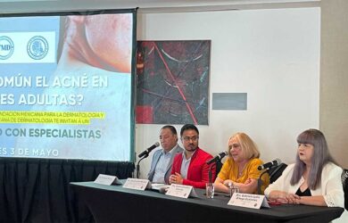 El acné no es solo cosa de adolescentes