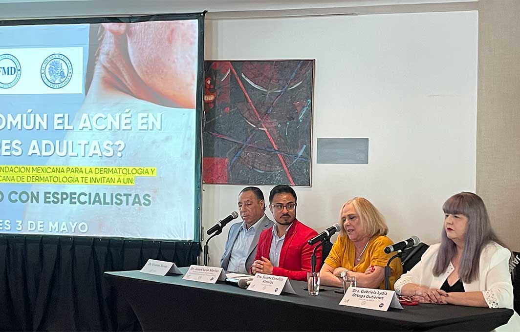 El acné no es solo cosa de adolescentes