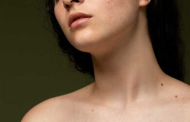 Piel Seca: Cuidado y Tratamientos Efectivos